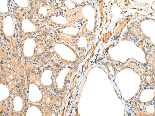Rabbit Polyclonal Antibody to KRT222