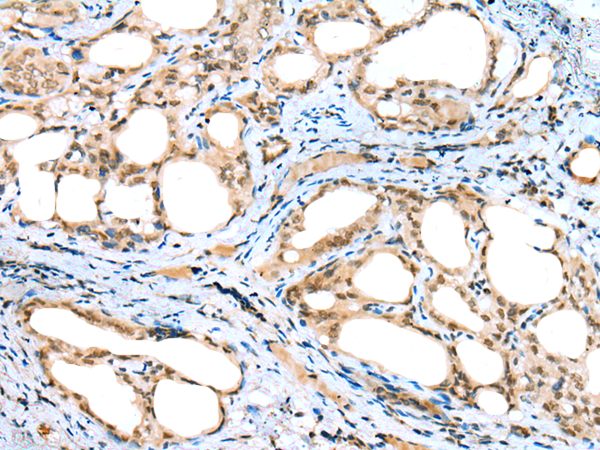 Rabbit Polyclonal Antibody to DTWD1