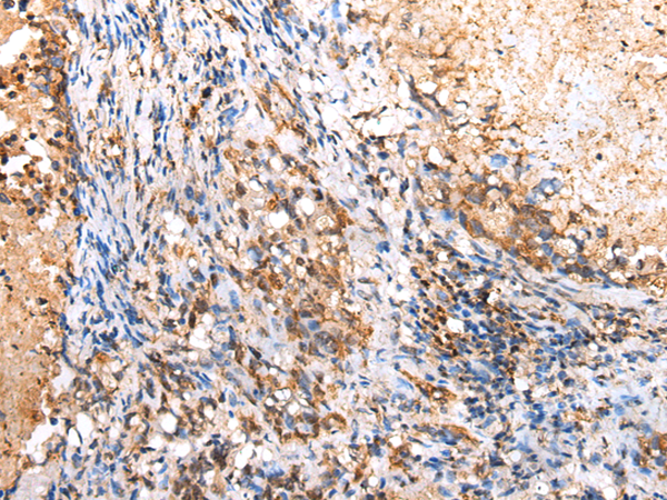Rabbit Polyclonal Antibody to RIMKLB