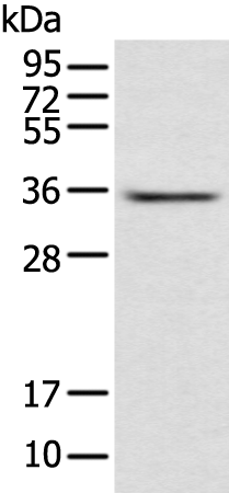 Rabbit Polyclonal Antibody to ACBD4