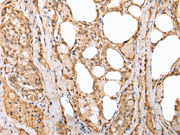 Rabbit Polyclonal Antibody to PHTF2