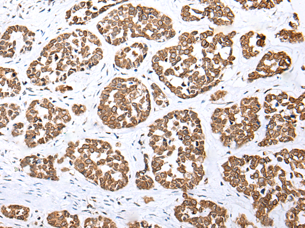 Rabbit Polyclonal Antibody to ZNF621