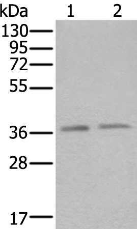 Rabbit Polyclonal Antibody to ATXN7L3