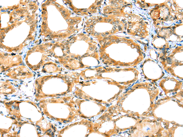 Rabbit Polyclonal Antibody to CBWD1
