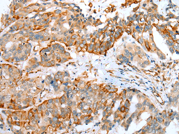 Rabbit Polyclonal Antibody to MYBPHL