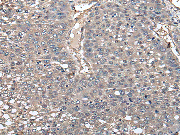 Rabbit Polyclonal Antibody to GCNT2