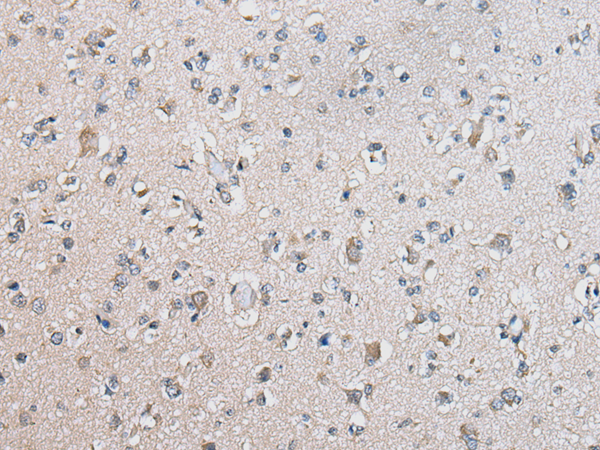 Rabbit Polyclonal Antibody to B4GALT5