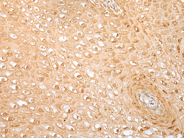 Rabbit Polyclonal Antibody to LSM11