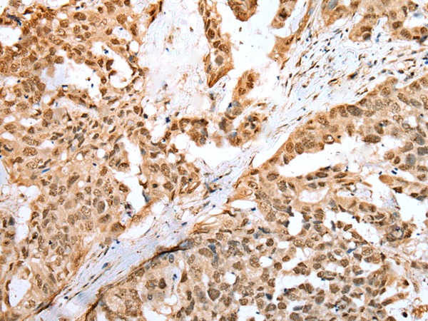 Rabbit Polyclonal Antibody to ZNF486