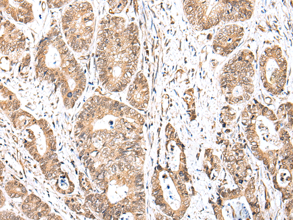Rabbit Polyclonal Antibody to UBXN2B