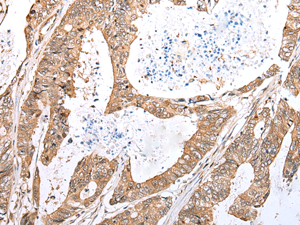 Rabbit Polyclonal Antibody to CASP5