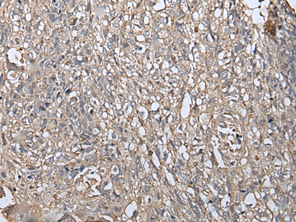 Rabbit Polyclonal Antibody to RUFY4