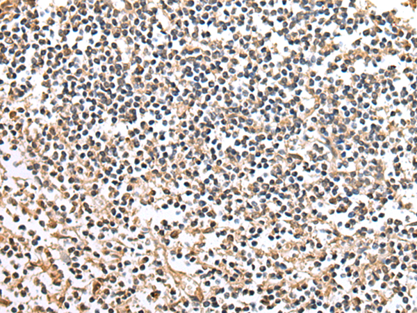 Rabbit Polyclonal Antibody to POMK