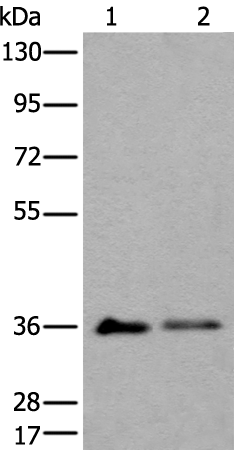 Rabbit Polyclonal Antibody to METAP1D