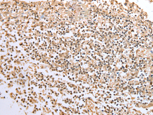 Rabbit Polyclonal Antibody to BCL7A