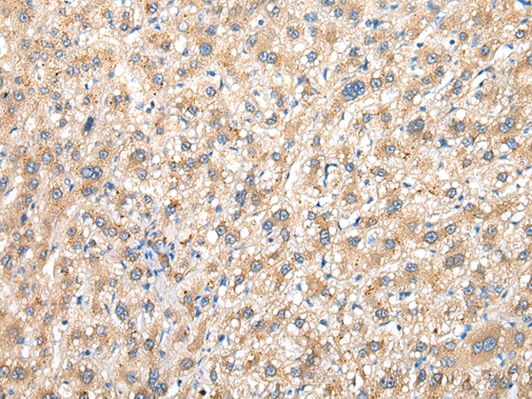 Rabbit Polyclonal Antibody to PRG3
