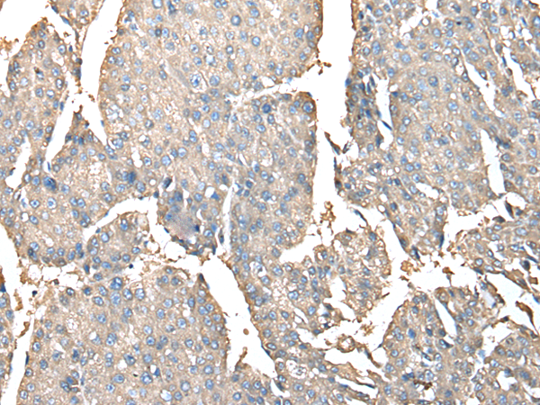 Rabbit Polyclonal Antibody to PRSS38