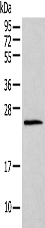 Rabbit Polyclonal Antibody to H1-6