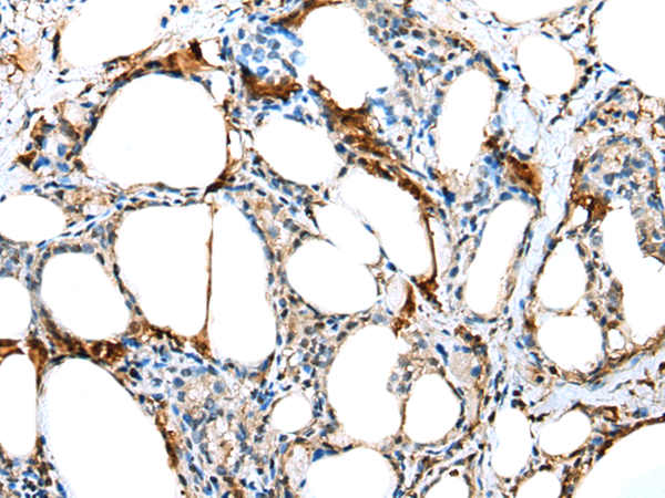 Rabbit Polyclonal Antibody to TCTE3