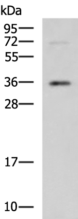 Rabbit Polyclonal Antibody to ITLN2