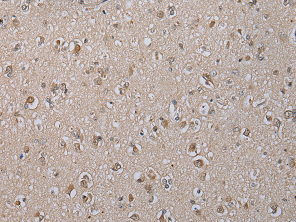 Rabbit Polyclonal Antibody to THEMIS2