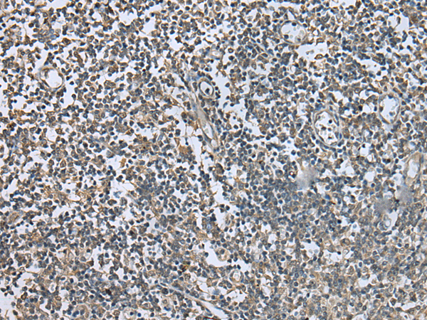 Rabbit Polyclonal Antibody to KAZN