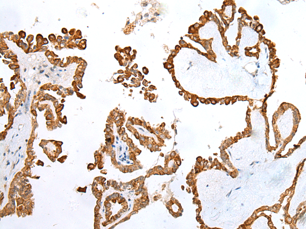 Rabbit Polyclonal Antibody to UBE2J2