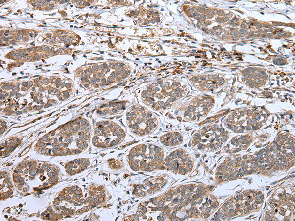Rabbit Polyclonal Antibody to DAND5