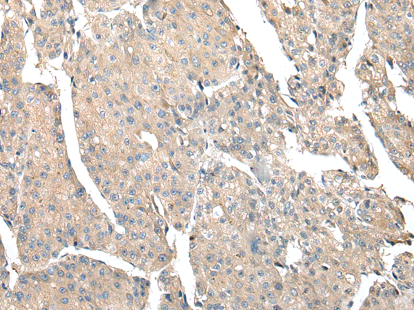 Rabbit Polyclonal Antibody to OIT3