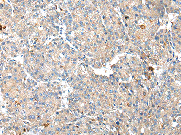 Rabbit Polyclonal Antibody to RSPH1