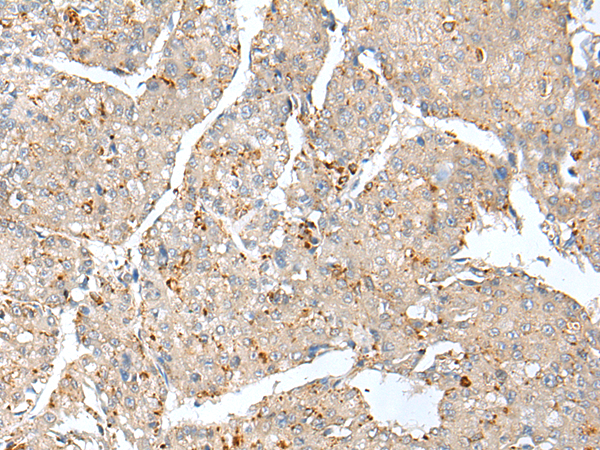 Rabbit Polyclonal Antibody to THEM5