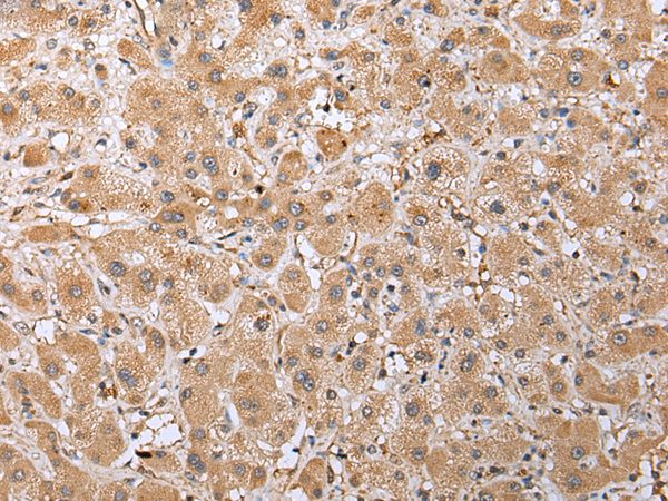 Rabbit Polyclonal Antibody to RAB41
