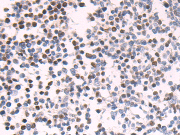 Rabbit Polyclonal Antibody to COMMD6