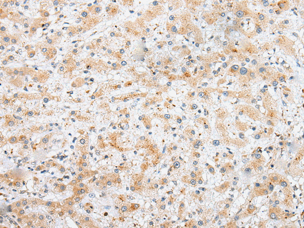 Rabbit Polyclonal Antibody to SYCE3
