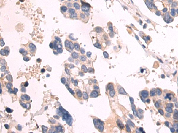 Rabbit Polyclonal Antibody to C4orf46