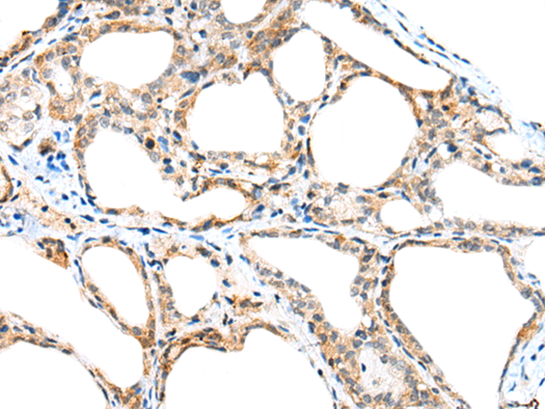 Rabbit Polyclonal Antibody to SPACA3