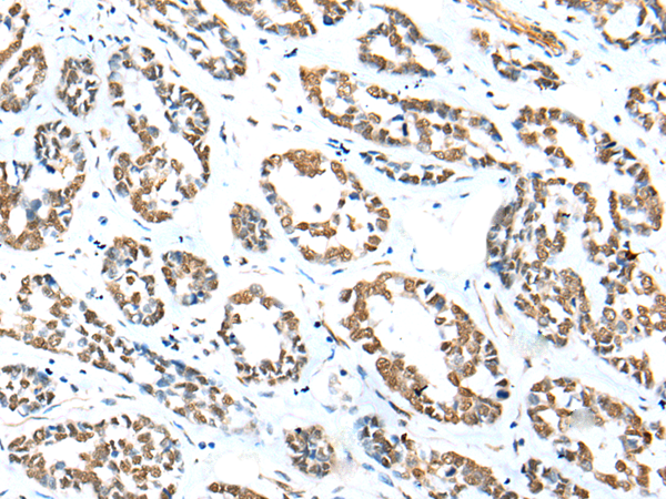 Rabbit Polyclonal Antibody to ZNF248