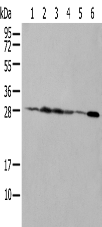 Rabbit Polyclonal Antibody to NUDT21