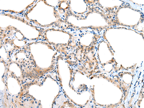 Rabbit Polyclonal Antibody to NUDT6