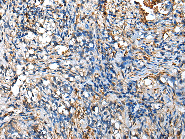 Rabbit Polyclonal Antibody to NUDT4