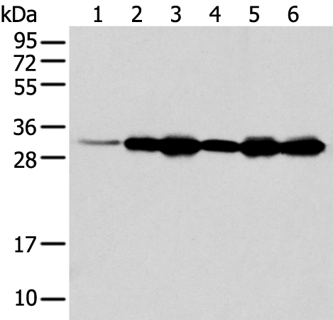 Rabbit Polyclonal Antibody to NUDT22