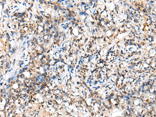 Rabbit Polyclonal Antibody to NUDT18
