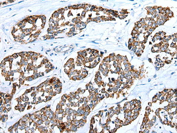 Rabbit Polyclonal Antibody to RHOV
