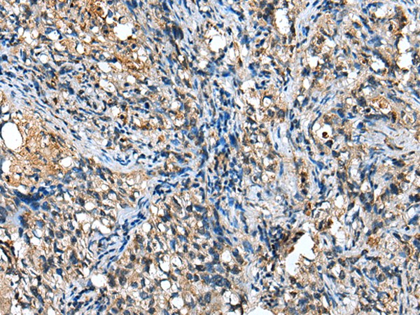 Rabbit Polyclonal Antibody to GSTM2
