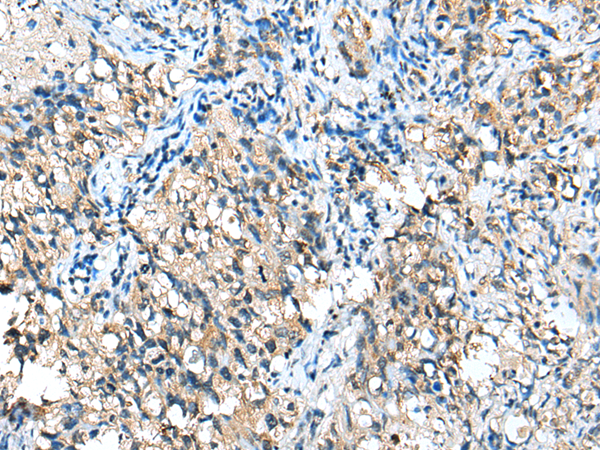 Rabbit Polyclonal Antibody to CFB