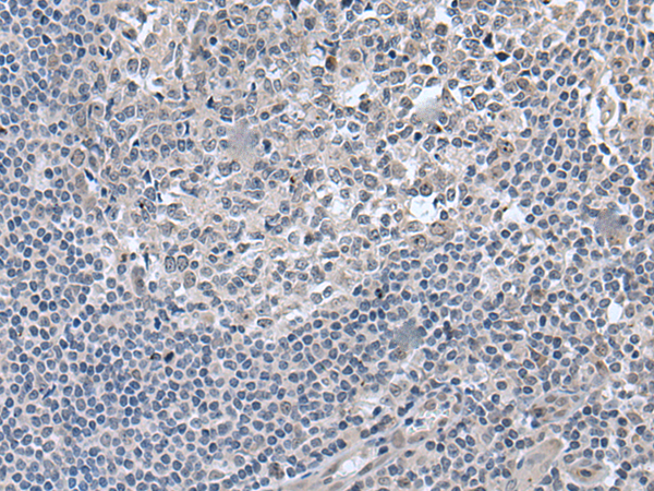 Rabbit Polyclonal Antibody to EDARADD