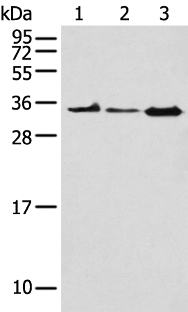 Rabbit Polyclonal Antibody to NPL