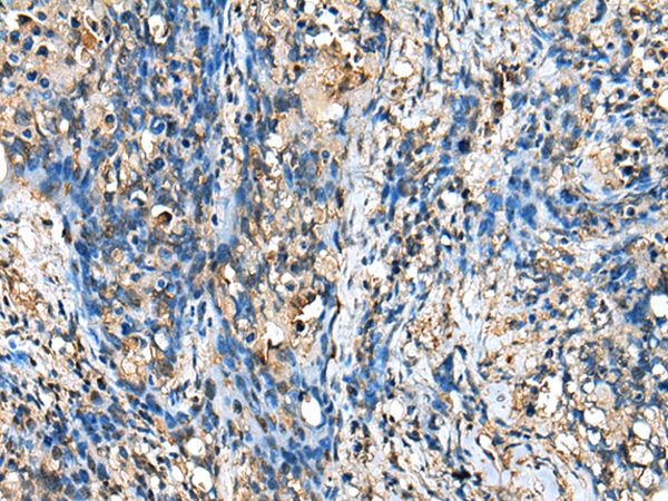 Rabbit Polyclonal Antibody to NDUFA12