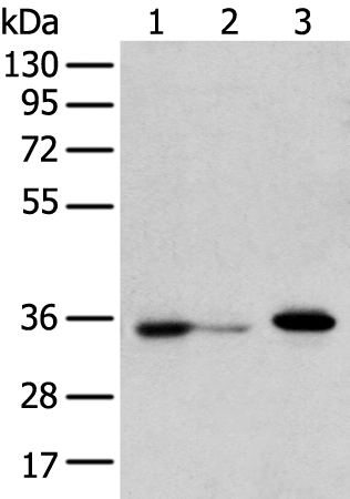 Rabbit Polyclonal Antibody to DHRSX