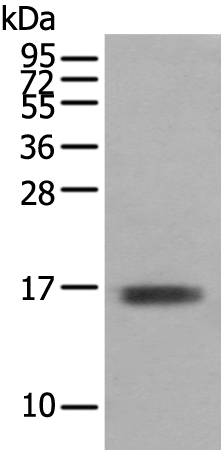 Rabbit Polyclonal Antibody to TNNC1